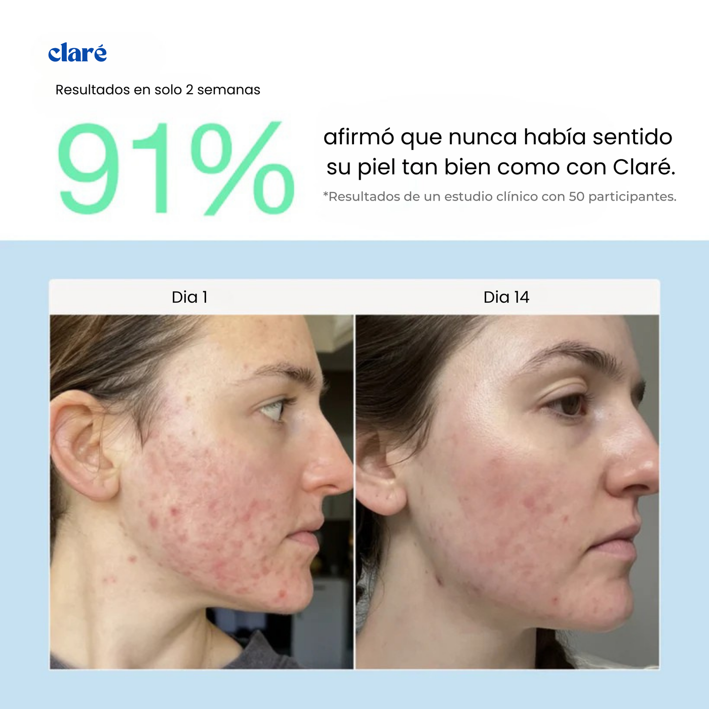 Filtro Facial Para Skincare
