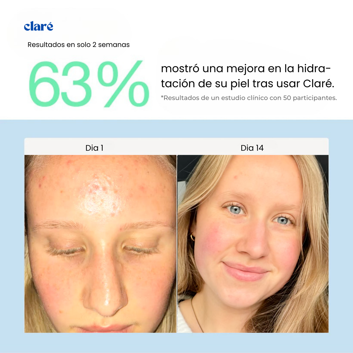 Filtro Facial Para Skincare